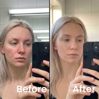 Lipid Barrier Balm™