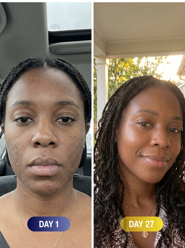 No irritation in six weeks