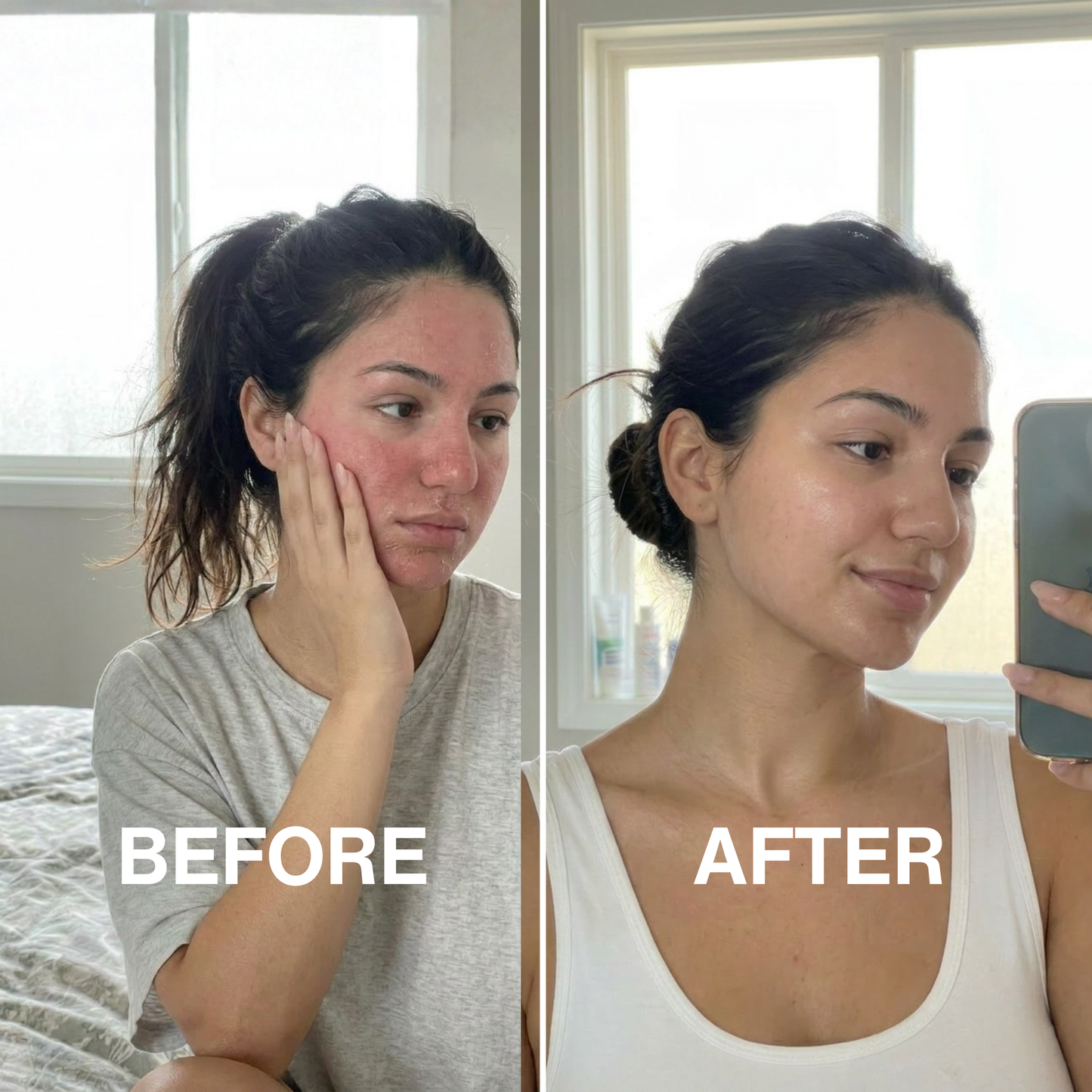 Lipid Barrier Balm™