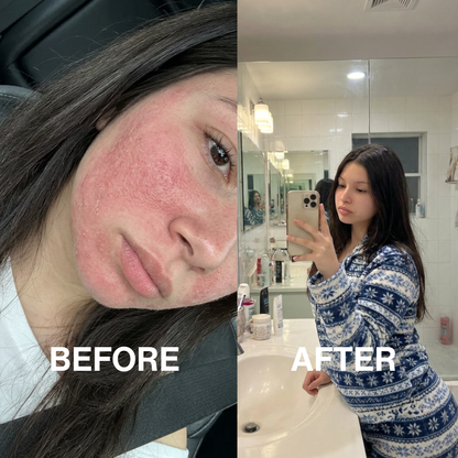 Lipid Barrier Balm™