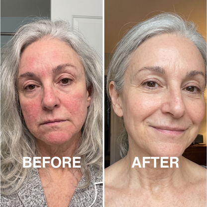 Lipid Barrier Balm™