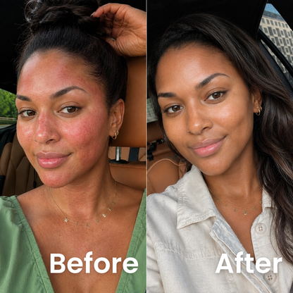 Lipid Barrier Balm™