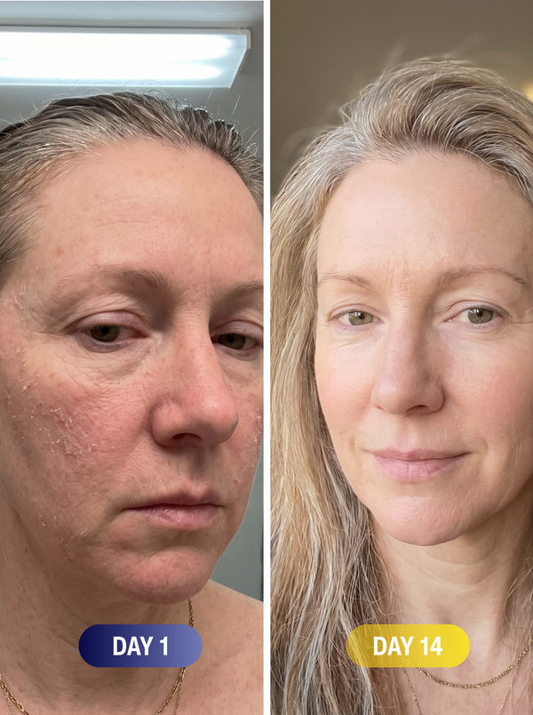 No irritation in six weeks
